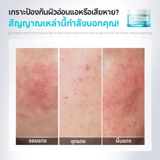 PAPA FEEL 5X Ceramide Barrier ครีมกู้ผิวเร่งด่วน ลดสิวและอาการระคายเคือง | บำรุงผิวให้ชุ่มชื้นอย่างล้ำลึก | เหมาะสำหรับผิวแพ้ง่าย Moisturizing Cream 30g