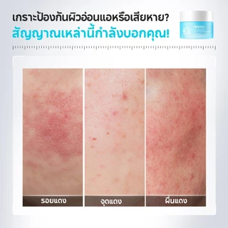 PAPA FEEL 5X Ceramide ซ่อมแซมเกราะป้องกันผิว Moisturizing Cream 80g | เหมาะสำหรับบอบบางและทุกสภาพผิว | ลดสิวและอาการระคายเคือง | และเพิ่มความยืดหยุ่นของผิว