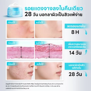 PAPA FEEL 5X Ceramide ซ่อมแซมเกราะป้องกันผิว Moisturizing Cream 80g | เหมาะสำหรับบอบบางและทุกสภาพผิว | ลดสิวและอาการระคายเคือง | และเพิ่มความยืดหยุ่นของผิว