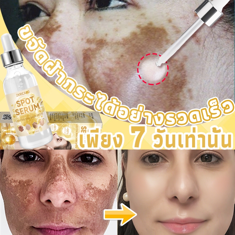 【นำเข้าจากประเทศเกาหลีใต้】เซรั่มลดฝ้า ครีมลดฝ้า ลดฝ้า กระ จุดด่างดำ ลดความหมองคล้ำ ปรับผิวให้ขาวกระจ่างใส