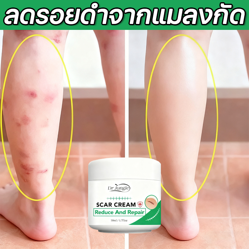 【COD】DR JUNGLE ครีมลดรอยแผลเป็น รอยดำจากแมลงกัด ครีมลดรอยแผลเป็นจากสิว ครีมลดรอยแผลเป็น ครีมฟื้นฟูรอยแผลเป็น ครีมจางรอยแผลเป็น 50g