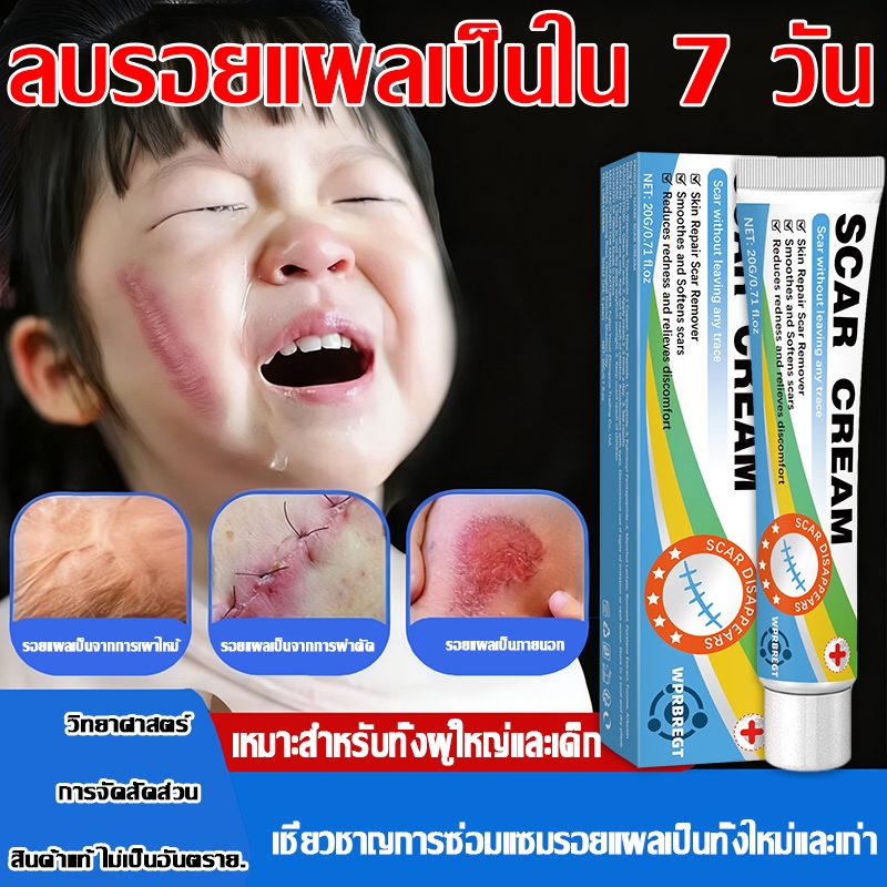 เจลลบรอยแผลเป็นที่ออกฤทธิ์เร็วซ่อมแซมผิวเสียหาย เช่น รอยแผลเป็นเสียดสี หลุมสิว เบิร์นรอยแผลเป็น หลังผ่าตัด แตกลาย