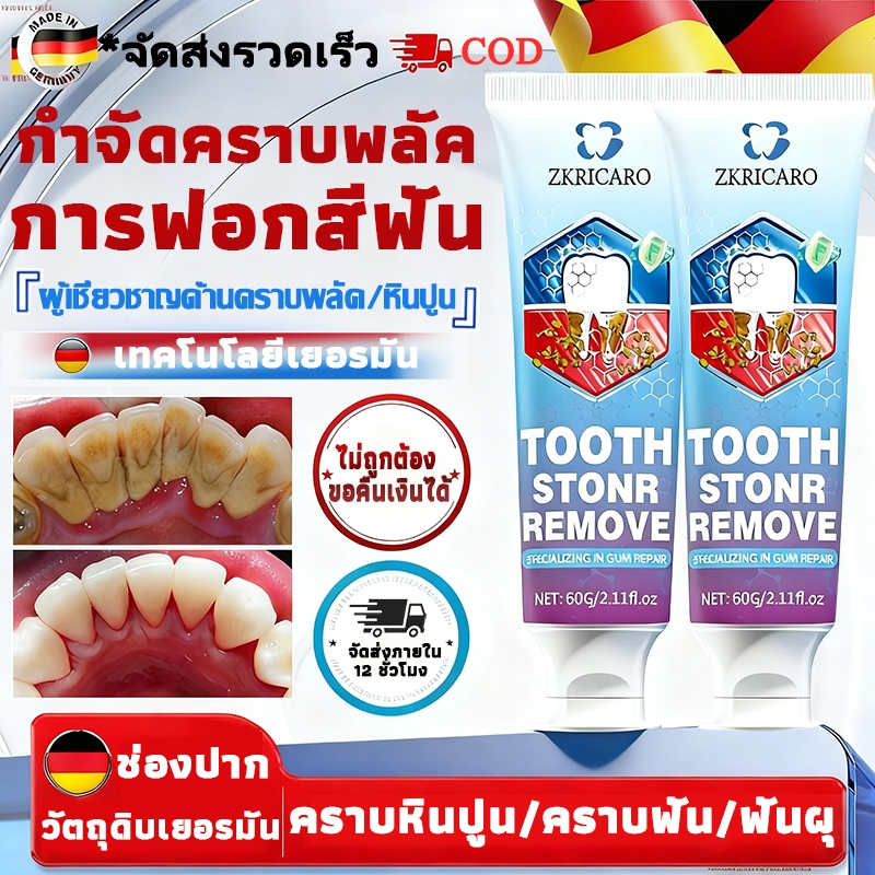 【นำเข้าจากเยอรมนี】ยาสีฟันฟอกฟันขาว ซ่อมแซมฟันผุอย่างรวดเร็ว ป้องกันผุ ขจัดคราบพลัค บรรเทาอาการปวดเหงือก กำจัดกลิ่นปาก ขจัดคราบพลัค ทำให้ลมหายใจสดชื่น และเสริมสร้างสุขภาพช่องปาก