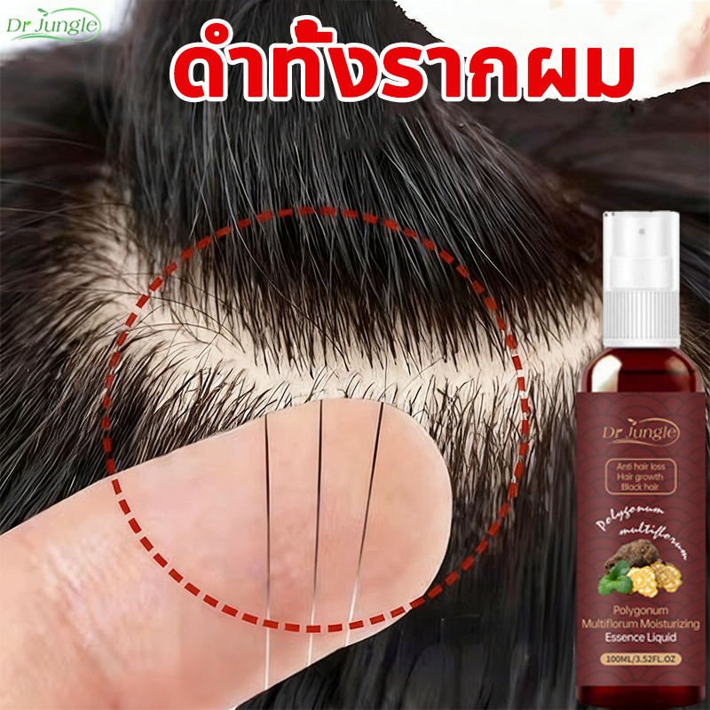 ของแท้ สเปรย์ปลูกผม เปลี่ยนผมขาวเป็นดํา บํารุงรากผม ลดผมหงอก ป้องกันผมร่วง ใช้สมุนไพรธรรมชาติ ขนาด 100 มล