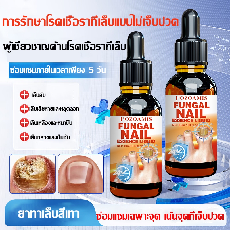 ผลลัพธ์ที่มองเห็นได้ภายใน 7 วัน เซรั่มซ่อมแซมเล็บ. เซรั่มบํารุงเล็บ รักษาการติดเชื้อที่เชื้อราที่เล็บ ซ่อมเล็บเปราะ แตก เหลือง