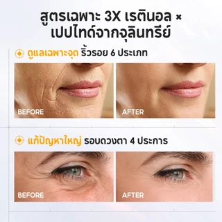 PAPA FEEL Anti Aging ลดริ้วรอย เนียนนุ่ม 4Pcs เรตินอล Moisturizer + เซรั่ม 5D Peptide อายครีม
