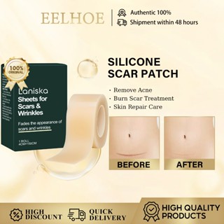 ซิลิโคนรอยแผลเป็นแพทช์กาวตนเองยืดเครื่องหมายซ่อมแซมแถบผิวเรี…