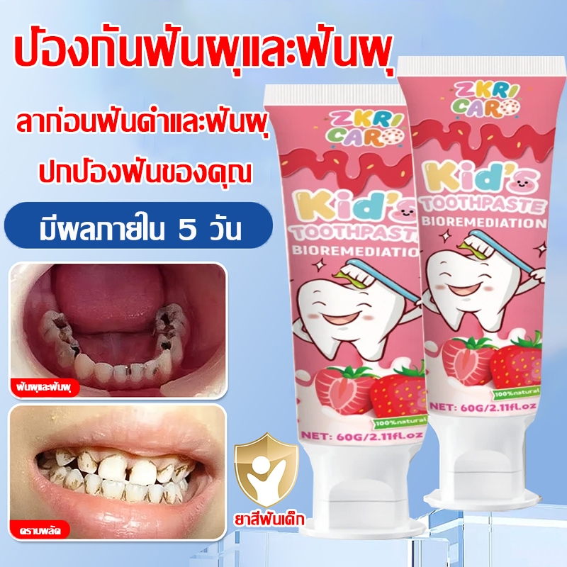 เด็ก ๆ ยาสีฟัน กลืนปลอดภัย ดูแลช่องปาก ลมหายใจสดชื่น ป้องกันฟันผุ ฟันเหลือง และฟันดํา มีฟลูออไรด์ปลอดภัย รสสตรอเบอร์รี