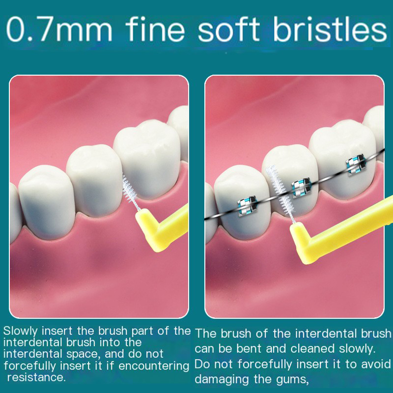 สุดยอดคอมโบ 50 ชิ้น: แปรงซอกฟันสองประเภท (รูปร่าง L & I)  | ชุดดูแลฟันครบชุดสําหรับทุกช่องว่างแปรงสีฟันสําหรับทําความสะอาดในระหว่างฟันจัดฟัน - รูปที่ 6