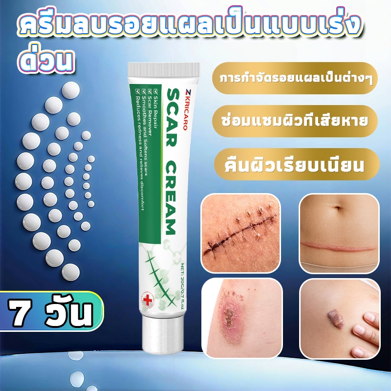 เจลลดเลือนรอยแผล รวมแผลนูน แผลผ่าตัด รอยแตกลาย และรอยสิว ใช้งานง่าย ผิวเรียบเนียน