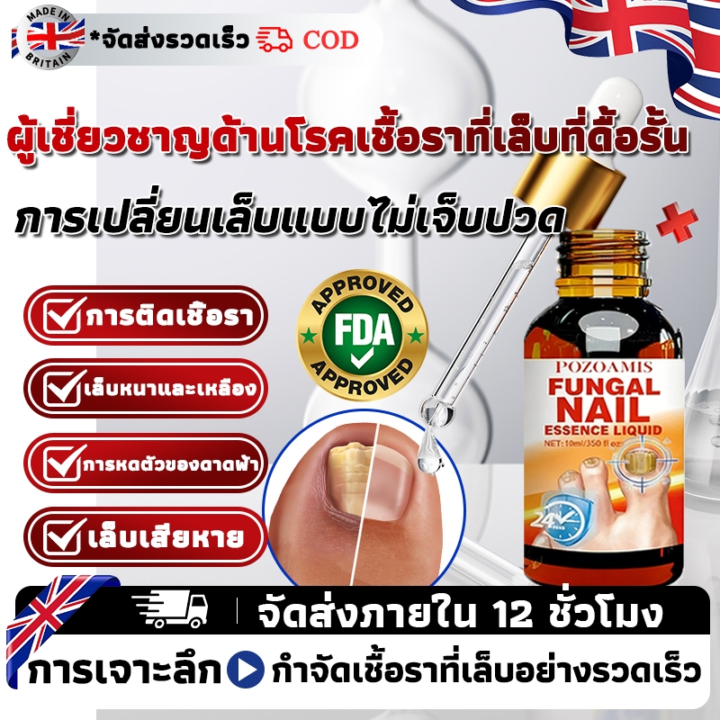โรคเชื้อราที่เล็บ ซ่อมแซม แก่นแท้ เชื้อราที่เล็บ ขจัดเชื้อราที่เล็บ โรคเชื้อราที่เล็บ รักษาเล็บเท้าคุด ซ่อมแซมการดูแลเล็บเบื้องต้น และรักษา โรคเชื้อราที่