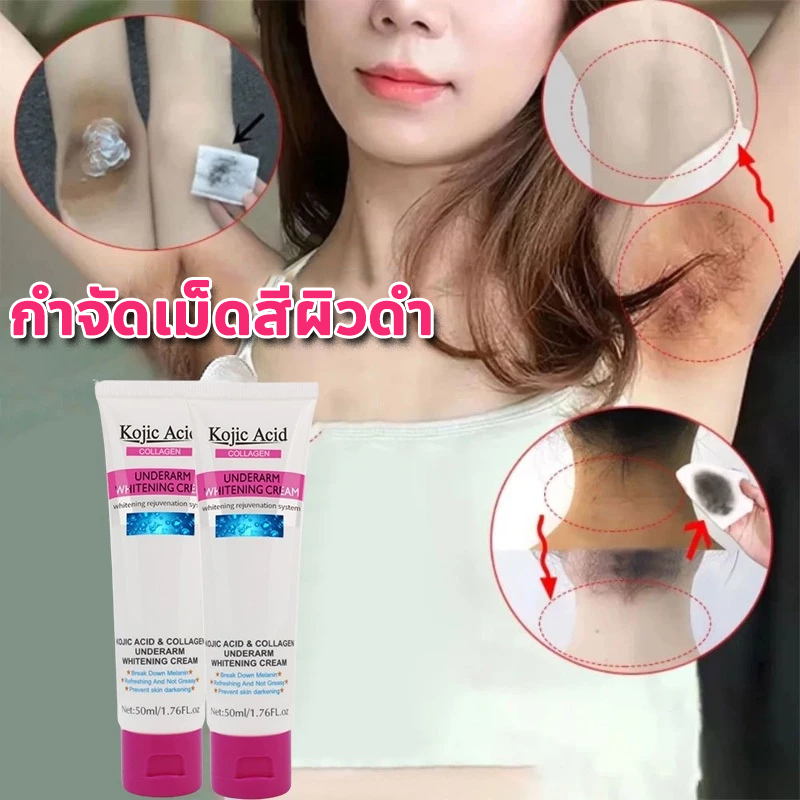 💕ของแท้💕 Kojic Acid ครีมทารักแร้ขาว ขาหนีบขาว ครีมขาวจุดซ่อนเร้น ลดเม็ดสีผิว ใช้ได้ทั้งร่างกาย ขาวใส