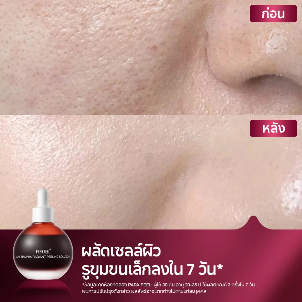 PAPA FEEL AHA BHA PHA Niacinamide Peeling Solution Serum thumbnail 4