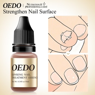 OEDO Antibacterial Nail Treatments Essential Extract Nail Fungus Serum Remove Onychomycosis Toe Nourishing Brighten Hand Foot Skin Care 10ml