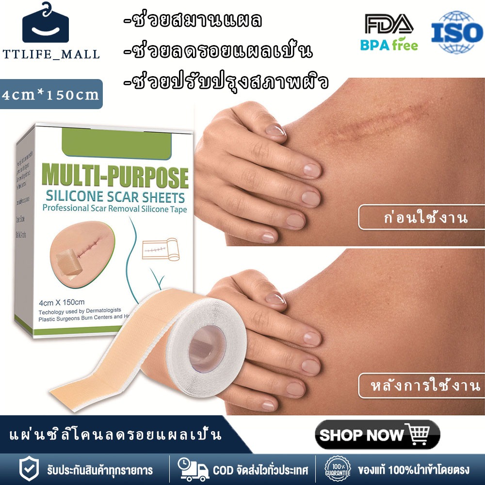 【คลังสินค้าในประเทศ + บริการเก็บเงินปลายทาง】แผ่นเจลซิลิโคน แผ่นแปะลดรอยแผลเป็น ใช้ซ้ำได้ สำหรับรักษาแผลเป็นจากบาดแผลและแผลไฟไหม้ ช่วยซ่อมแซมผิวและลดรอยแผลเป็น
