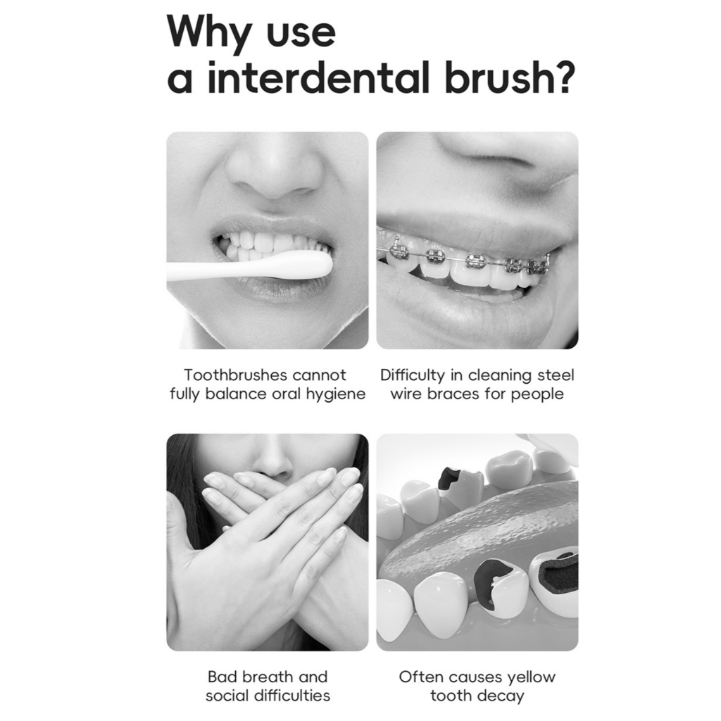 สุดยอดคอมโบ 50 ชิ้น: แปรงซอกฟันสองประเภท (รูปร่าง L & I)  | ชุดดูแลฟันครบชุดสําหรับทุกช่องว่างแปรงสีฟันสําหรับทําความสะอาดในระหว่างฟันจัดฟัน - รูปที่ 3