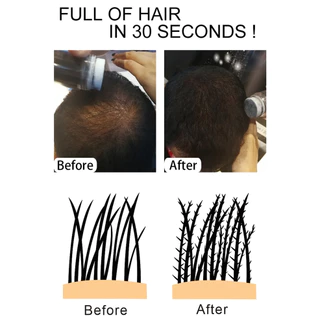 🚀ส่งจากไทย🚀 ชุด 3 Toppik Hair Building Fiber 27.5g Hair Loss Building Fibers สีดํา/BROWN SET