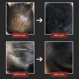 🚀ส่งจากไทย🚀 ชุด 3 Toppik Hair Building Fiber 27.5g Hair Loss Building Fibers สีดํา/BROWN SET