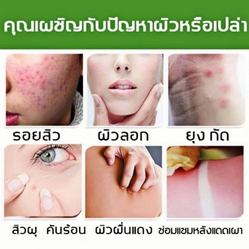 เจลว่านหางจระเข้บำรุงผิวหน้าและผิวกาย thumbnail 8