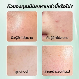 【PORCOPE】โฟมล้างหน้า การควบคุมความมัน ลดสิว ผิวกระจ่างใส Brightening Cleanser 200 กรัม