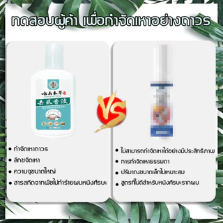 แชมพูกําจัดเหา 120มล กําจัดเหาอย่างมีประสิทธิภาพสูงสุด99%ผมทําความสะอาดลึกกําจัดขนถาวรเหาและไข่แชมพูกําออร์แกนิกสมุนไพร