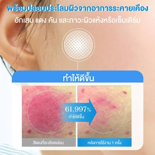 【สูตรปรับใหม่! 】Cokki มอยเจอร์ไรเซอร์ 80g soothing moisturizer cream B5 บาล์มบำรุงผิว ช่วยปลอบประโลม ฟื้นบำรุงผิว