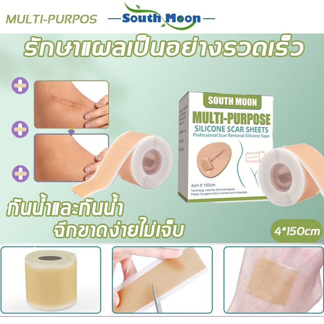 【จัดส่งจากกรุงเทพฯ】South Moon แผ่นแปะรอยแผลเป็น แผ่นแปะแผลเป็น 150cm ลบรอยแผลเป็นแผลผ่าตัด น้ำร้อนลว