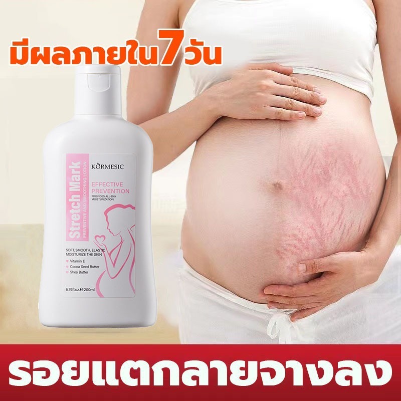 [7 วันจางลงรอยแตกลาย] Stretch Mark Repair Cream, Stretch Mark Spray,ซ่อมแซมผิวหลังคลอดโดยเฉพาะ