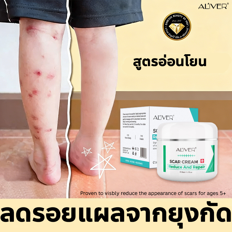 ✨ของแท้✨ ALIVER ครีมลดรอยแผล สามารถลบรอยกัดยุงได้ ช่วยลดความชัดเจนของรอยแผลและส่งเสริมการสร้างเซลล์ผิวใหม่ ฟื้นฟูผิวให้เนียนเรียบ ใช้ต่อเนื่องจะช่วยปรับสีและเนื้อผิวให้ดีขึ้น ผิวสุขภาพดีและมั่นใจมากขึ้น ขนาด 50ml