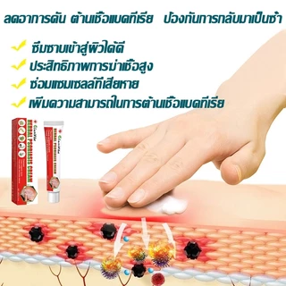 ครีมสะเก็ดเงิน ครีมต้านเชื้อรา ครีมแก้คัน แก้ผดผื่นคัน แก้การติดเชื้อรา ทาผิว ซ่อมผิว