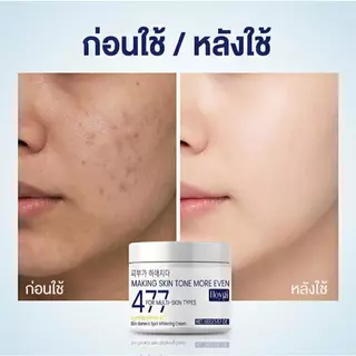 ซื้อหนึ่งแถมหนึ่ง 477 ครีมหน้าขาวใส ลบเลือนจุดด่างดํา ผิวขาว ชุ่มชื้น ขาวใสอย่างมีประสิทธิภาพ