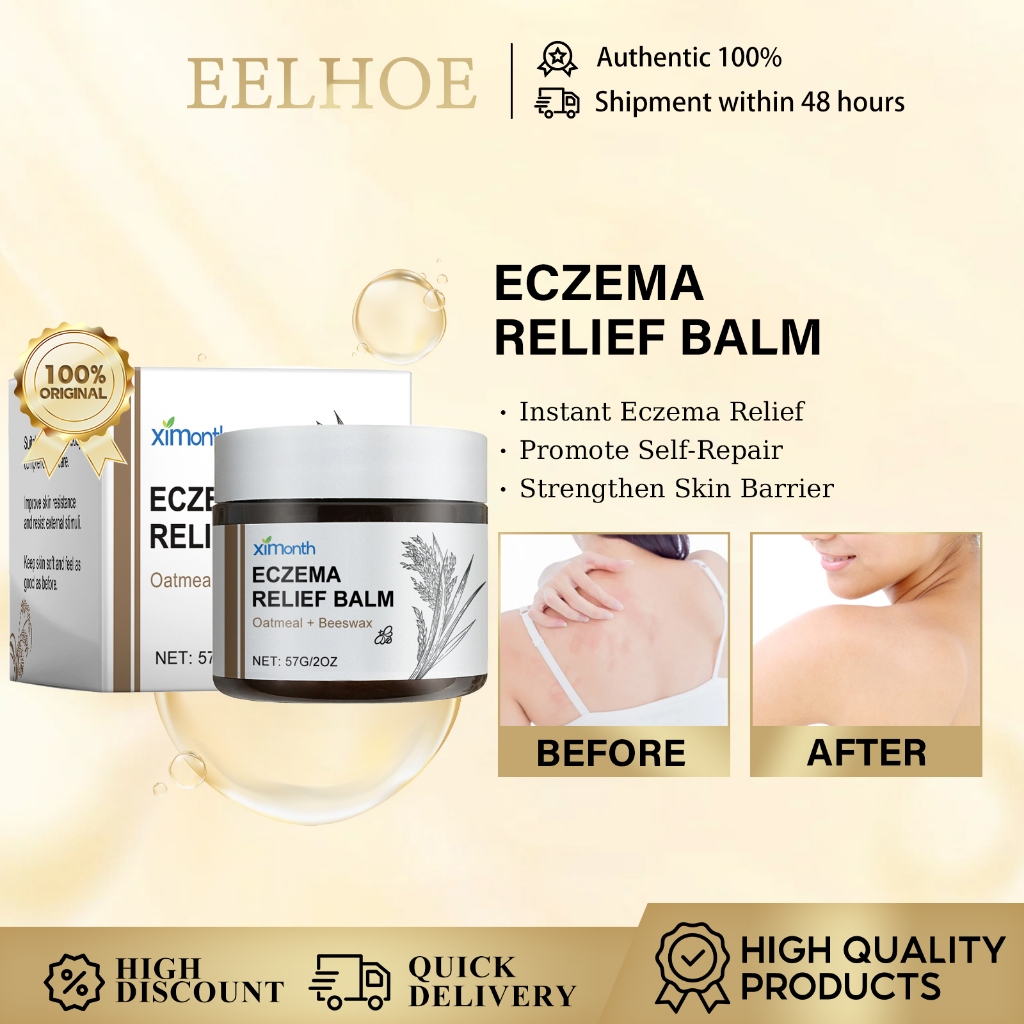 Ximonth Eczema Cream Mild Soothing Eczema อาการคันสีแดงบวมผิวบํารุงผิวครีมให้ความชุ่มชื้น 57G