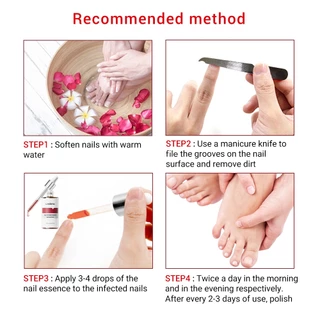 LANBENA Nail Repair Essence 15ml น้ำตบบำรุงเล็บ ซ่อมแซมเล็บเสีย ฟื้นฟูให้ขาวใส บำรุงมือและเล็บเท้า