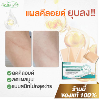🔥ของแท้🔥Drjungle แผ่นแปะลดรอยแผลเป็น แผ่นแปะซิลิโคน ลดรอยแผล…