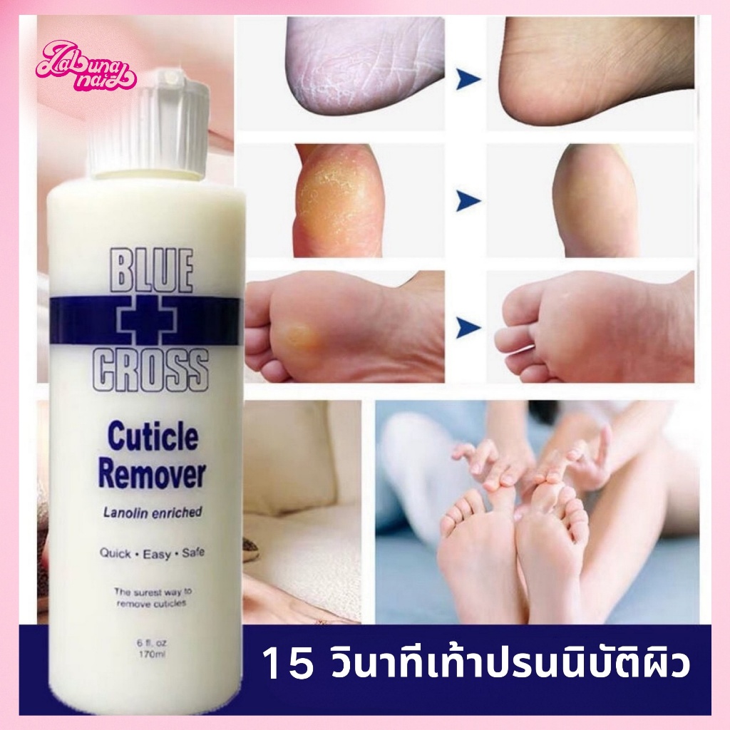 【พร้อมส่ง】BLUE CROSS น้ำยาตัดหนัง หนังนิ่ม น้ำยาหนังนิ่ม เตรียมหน้าเล็บ ตัดหนังเล็บ น้ำยาตัดหนังเล็บ ครีมตัดหนัง ขนาด6 oz. (177ml. ) 16 oz. (473ml. )