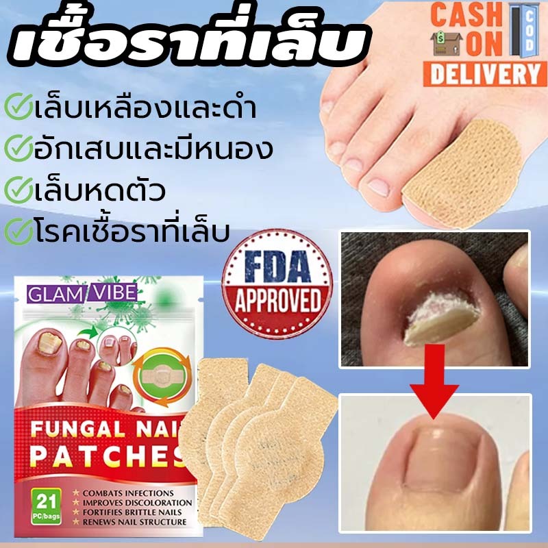 [นําเข้าจากญี่ปุ่น] ผลที่มองเห็นได้ภายใน 7 วัน.Nail Repair Essence.Care สําหรับเล็บ การติดเชื้อรา ป้องกันเล็บเปราะบาง Easy Break