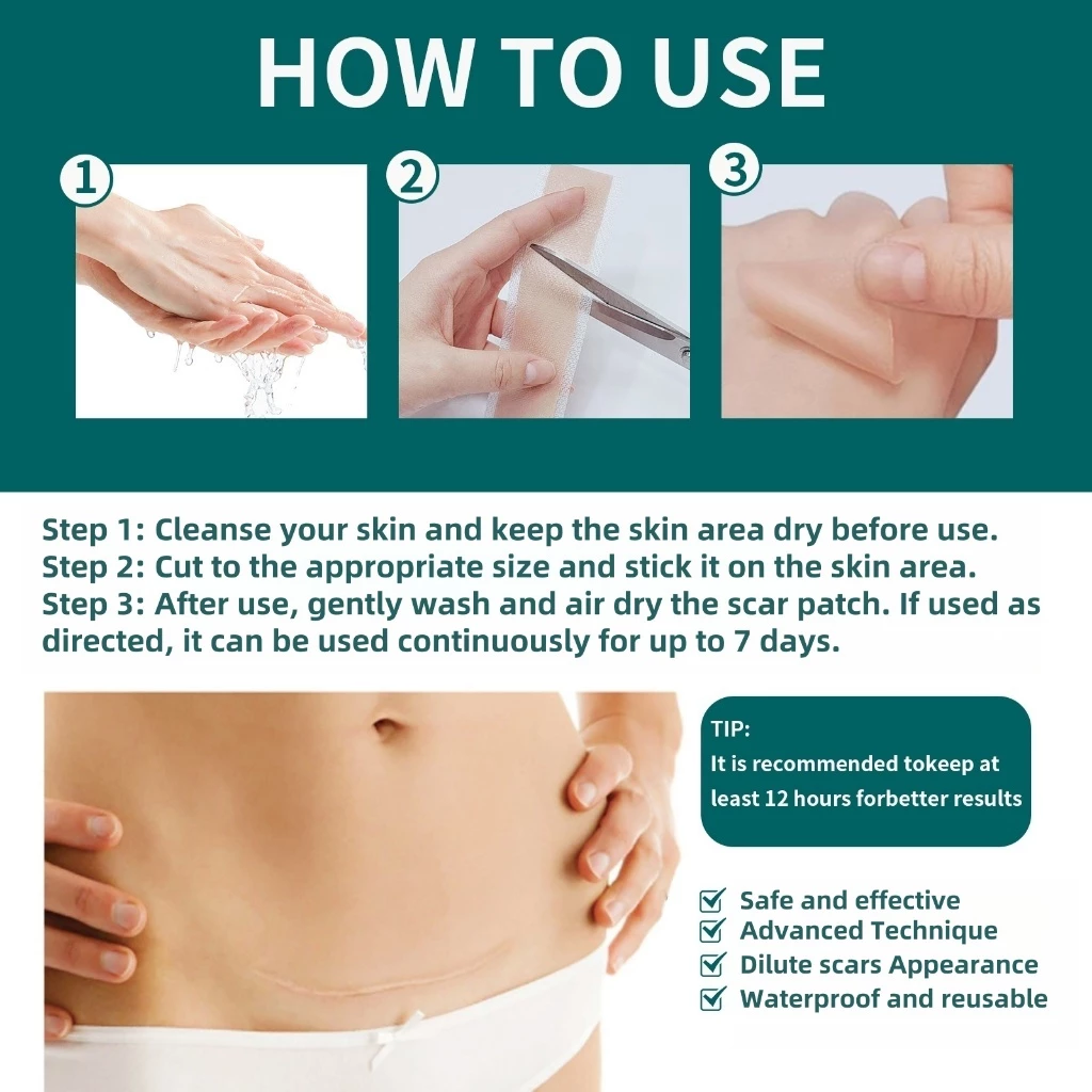 QUSTERE ซิลิโคน Skin Care เทป 2M ม้วน (1.6" x 60") แผ่นแปะผิวกันน้ําอ่อนโยนสําหรับผิวแพ้ง่าย แผ่นแปะสิว thumbnail 3