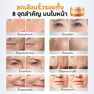 PAPA FEEL [2Pcs] เซรั่ม&ครีมหน้า | 5X Ceramide ซ่อมเกราะป้องกันผิว | 577 Dark Spot ลดรอยด่าง | Ultra 5A Retinol ต่อต้านริ้วรอย | AHA Peeling ผลัดเซลล์ผิวเก่า | ผิวชุ่มชื้น กระจ่างใส