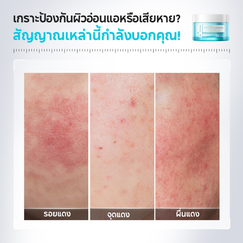 PAPA FEEL เซตสุดคุ้ม 5 ชิ้น : เช้า C เย็น A ครีมทาหน้า เซรั่ม Eye Cream ลดริ้วรอย ลดฝ้า ฟื้นฟูผิว [SET] - รูปที่ 4