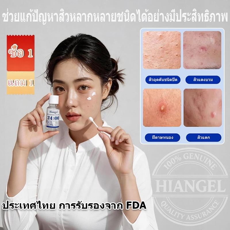 เอสเซนส์รักษาสิวไนอะซินาไมด์ กำจัดสิวได้อย่างมีประสิทธิภาพและรวดเร็ว บรรเทาอาการอักเสบ ลดรอยแผลเป็นจากสิว การควบคุมน้ำมัน การป้องกันการเกิดสิวซ้ำ Niacinamide Acne Treatment Serum Hiangel