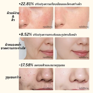 NIPLIFE TheraFace Mask มาส์กนวดไบโอไลท์ LED Therapy