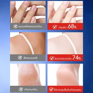 SADOER Urea Body Lotion เซ็ตครีมยูเรีย ปรับปรุงผิวเปลือกไก่ ขจัดเซลลูไลท์ ผิวชุ่มชื้น 48H (3ชิ้น)