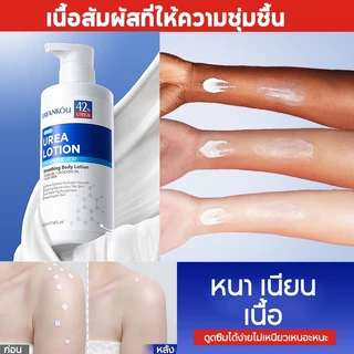 SADOER Urea Body Lotion เซ็ตครีมยูเรีย ปรับปรุงผิวเปลือกไก่ ขจัดเซลลูไลท์ ผิวชุ่มชื้น 48H (3ชิ้น)