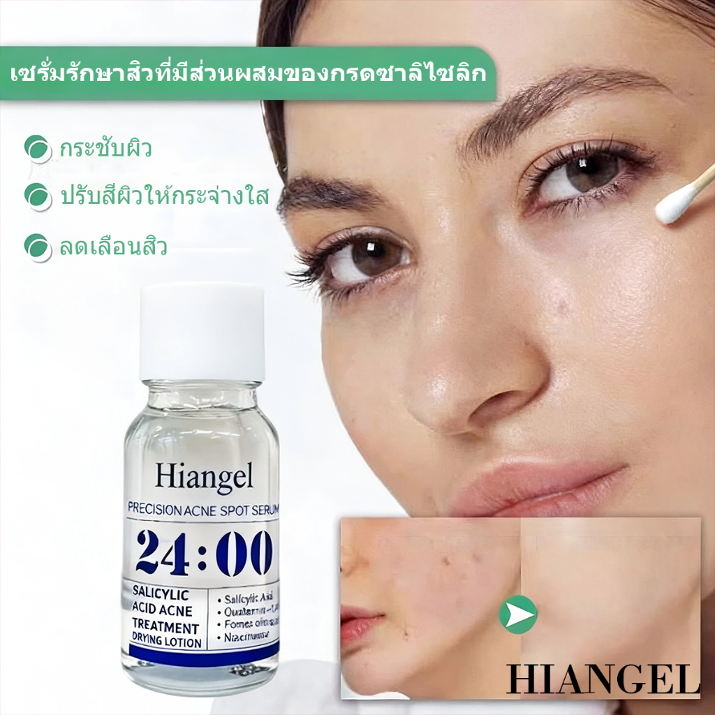 HIANGEL เซรั่มรักษาสิว 24 ชั่วโมง พร้อมกรดซาลิไซลิก 3%