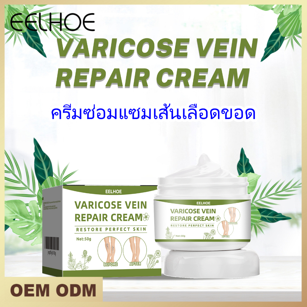 EELHOE ครีมซ่อมแซมเส้นเลือดขอด ครีมบำรุงขา บรรเทาอาการปวดขา IV Repair Cream ครีมบรรเทาเส้นเลือดขอดแมงมุม 50 กรัม