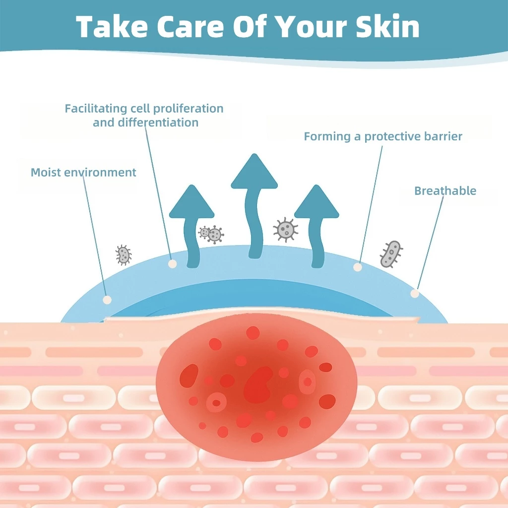 QUSTERE Hydrocolloid Acne Patch กันน้ําที่มองไม่เห็น Pimple Spot Patch สําหรับทุกสภาพผิว แผ่นแปะสิว thumbnail 3