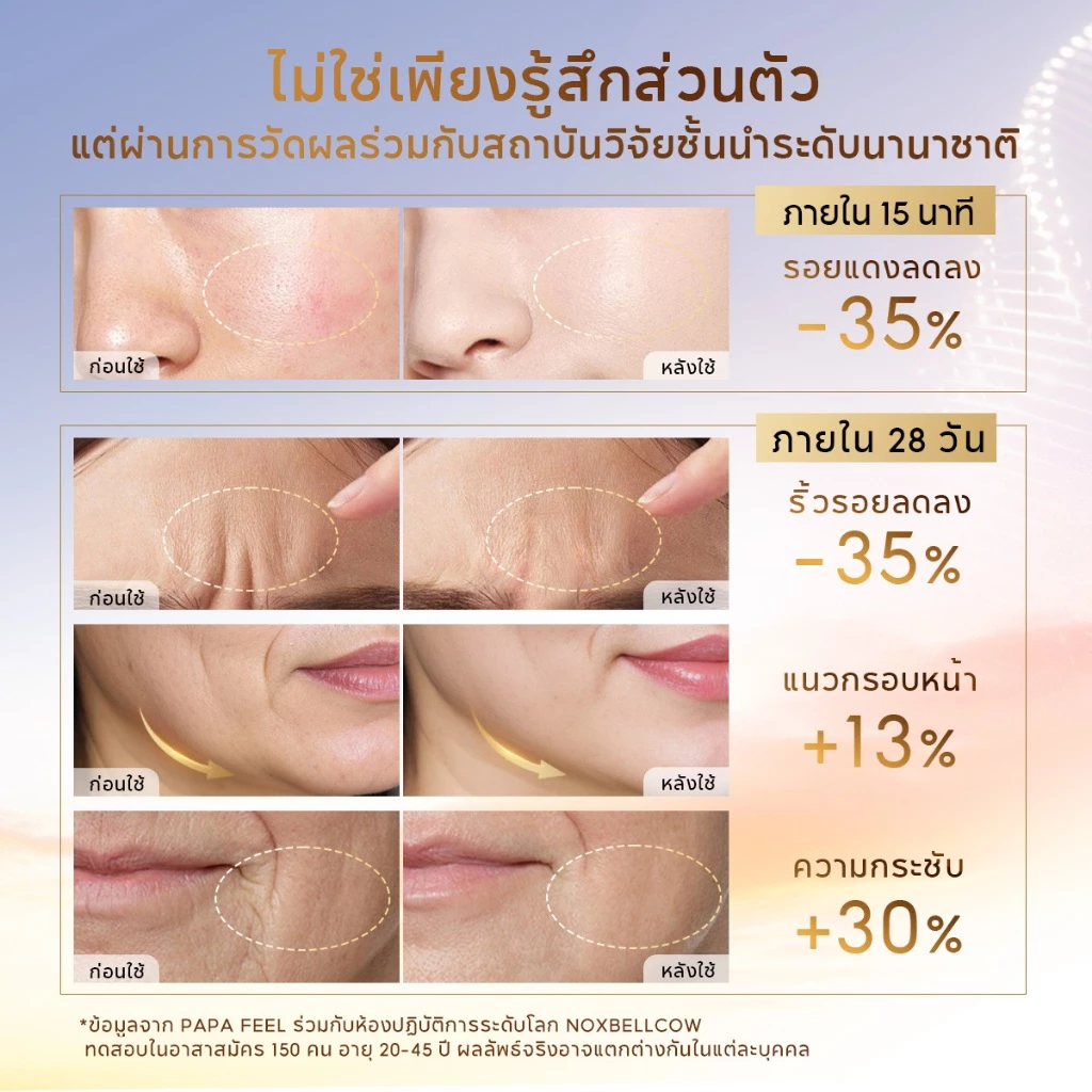 PAPA FEEL [FDA รับรอง] 12X เซ็ทสกินแคร์ระดับเซลล์ 4 ชิ้น CELLULAR BARRIER RECOVERY FIRMING CREAM 50g + MICRO-CAPSULE SERUM 30ml + MICRO-CAPSULE TONER 100ml + SOOTHING CLEANSER 100ml เหมาะสำหรับผิวมีริ้วรอย|เกราะผิวอ่อนแอ, เนื้อบางเบา ใช้ได้กับผิวแพ้ง่าย thumbnail 4