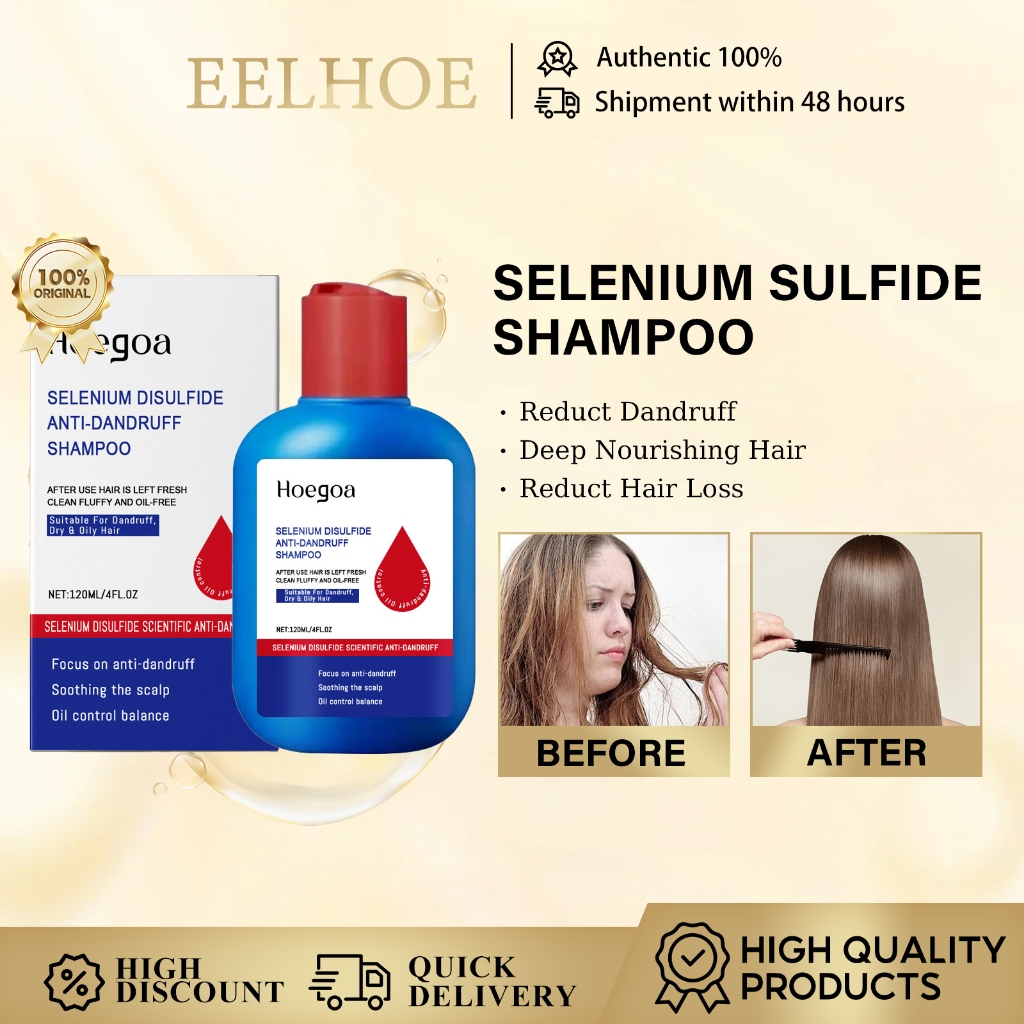 Hogoa Selenium Sulfide Shampoo 100g Anti Dandruff ทําความสะอาดล้ําลึกลบหนังศีรษะคันควบคุมน้ํามันดูแล