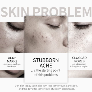 [FDA & 3 ชิ้น ฿189] SHEEureka Facial Scrub เจลขัดผิวหน้าสกัดจากสมุนไพร 50 กรัม ช่วยลดเซลล์ผิวที่ตายแล้วและทำให้ผิวมีสุขภาพดี