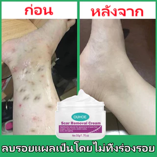 COD ของแท้ มลดรอยแผลเป็น แผลเป็น รแผลไฟไหม้ น้ำร้อนลว แผลผ่าตัด รอยแตกลายหลังครรภ์ แผลใหม่และแผลเป็นเก่า 50ml
